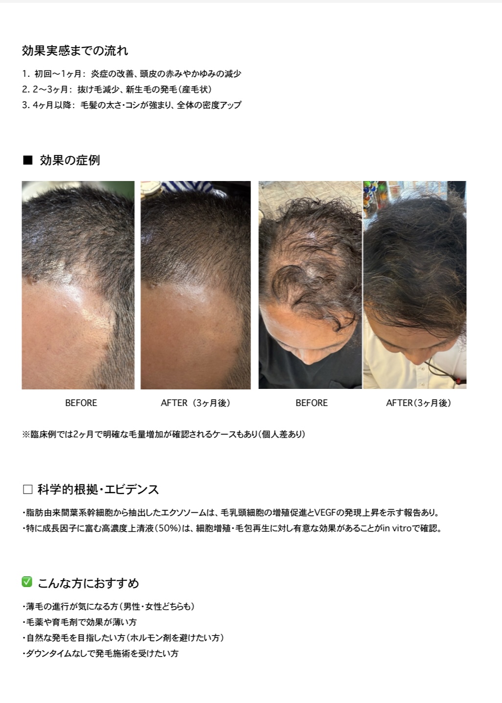 R.K エクソセラム 25 エクソソーム上精液 - 画像 (10)